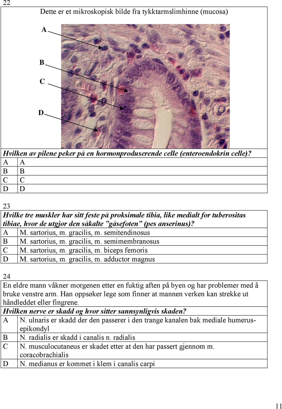 semitendinosus B M. sartorius, m. gracilis, m. semimembranosus C M. sartorius, m. gracilis, m. biceps femoris D M. sartorius, m. gracilis, m. adductor magnus 24 En eldre mann våkner morgenen etter en fuktig aften på byen og har problemer med å bruke venstre arm.