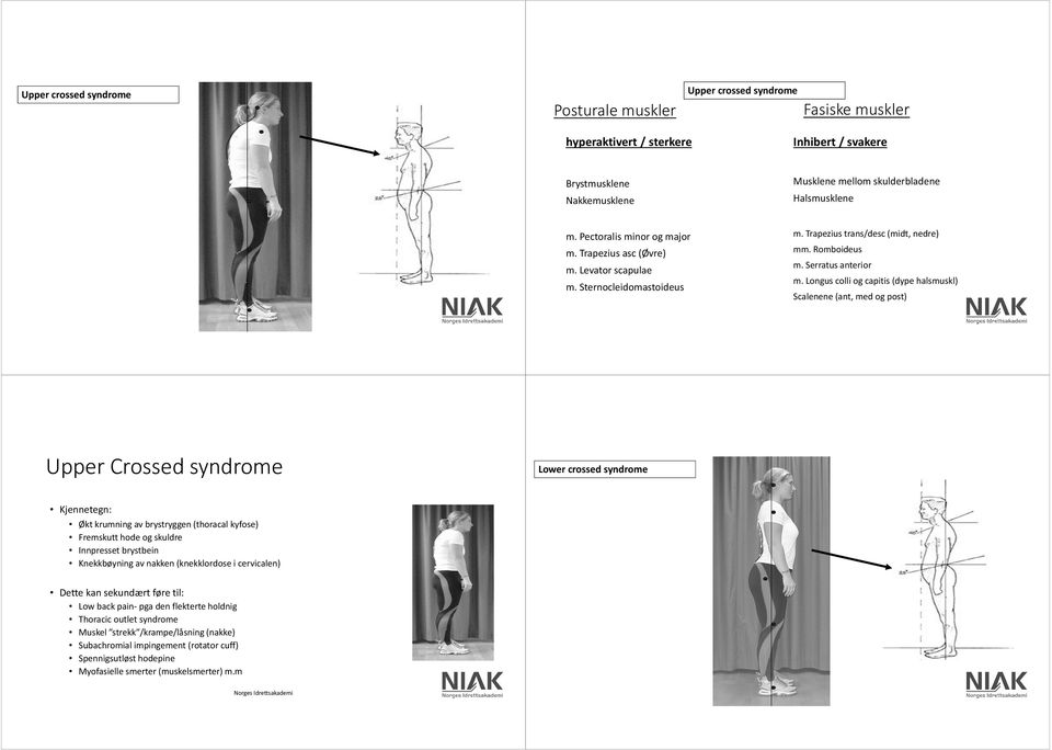 Longus colli og capitis (dype halsmuskl) Scalenene (ant, med og post) Upper Crossed syndrome Lower crossed syndrome Kjennetegn: Økt krumning av brystryggen (thoracal kyfose) Fremskutt hode og skuldre