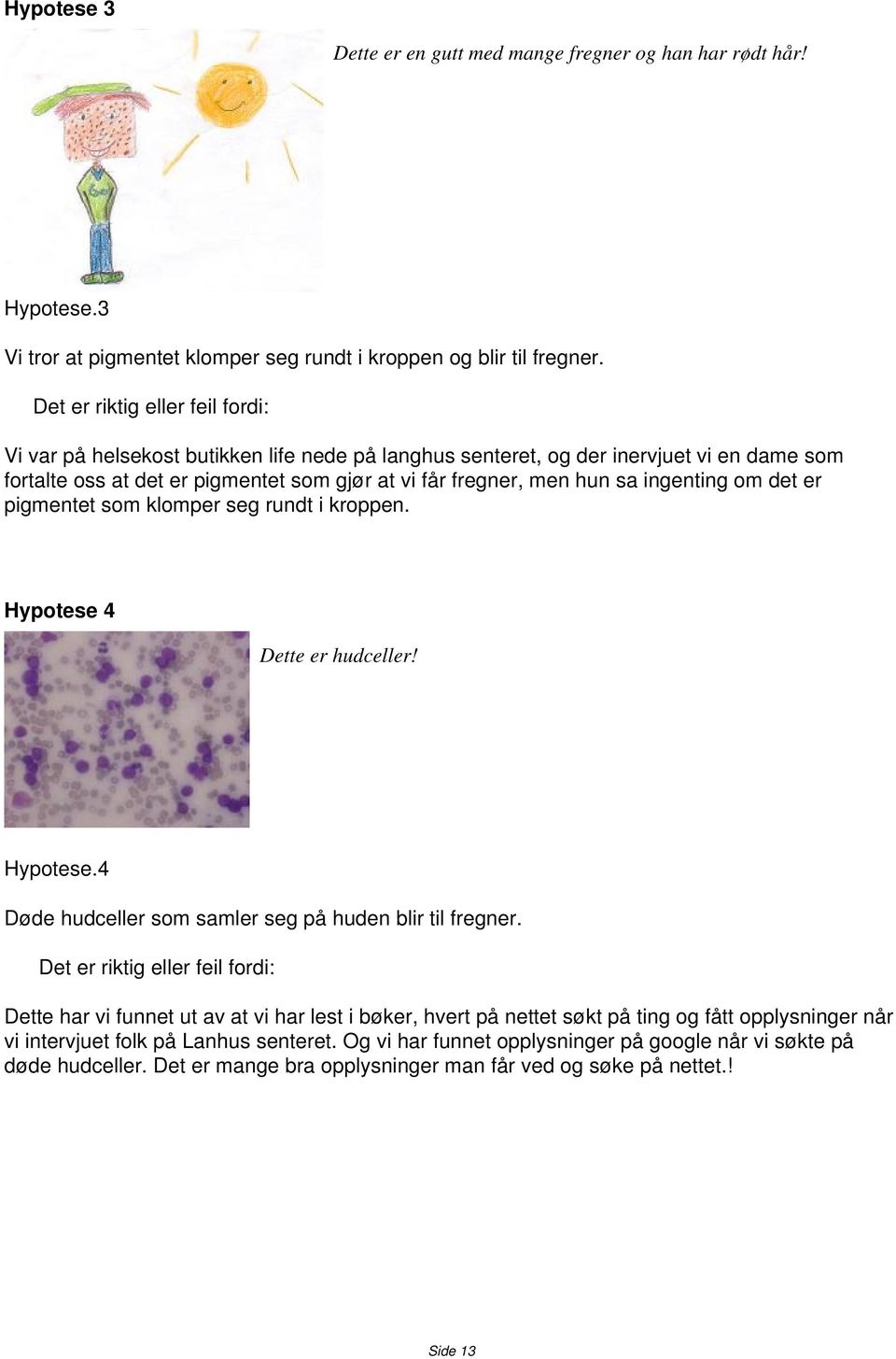 ingenting om det er pigmentet som klomper seg rundt i kroppen. Hypotese 4 Dette er hudceller! Hypotese.4 Døde hudceller som samler seg på huden blir til fregner.