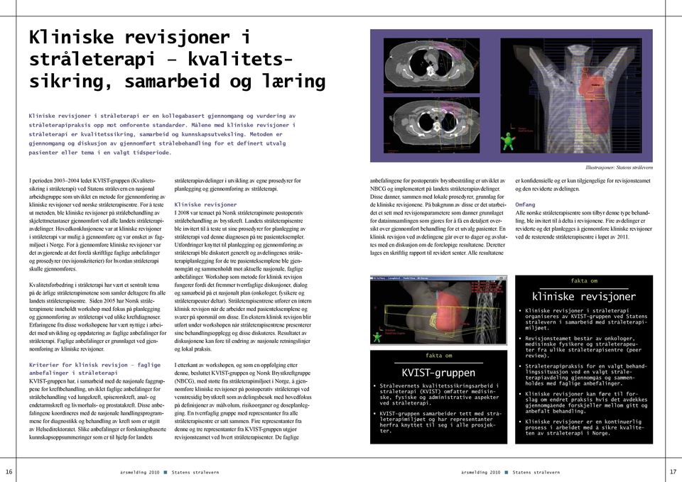 Metoden er gjennomgang og diskusjon av gjennomført strålebehandling for et definert utvalg pasienter eller tema i en valgt tidsperiode.