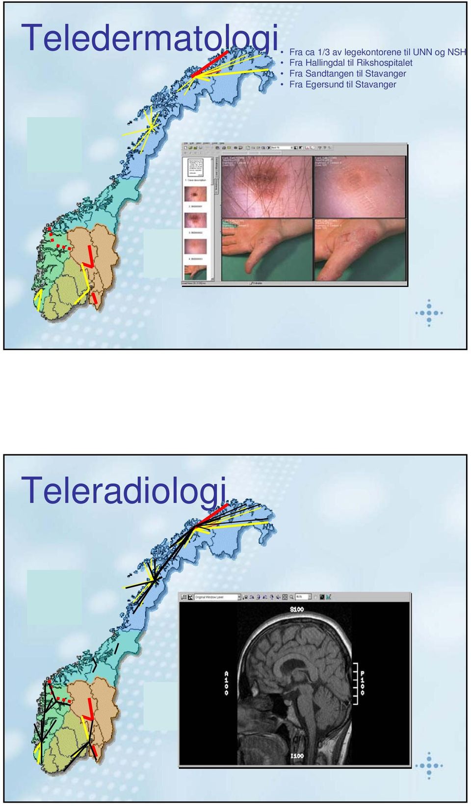 Hallingdal til Rikshspitalet Fra