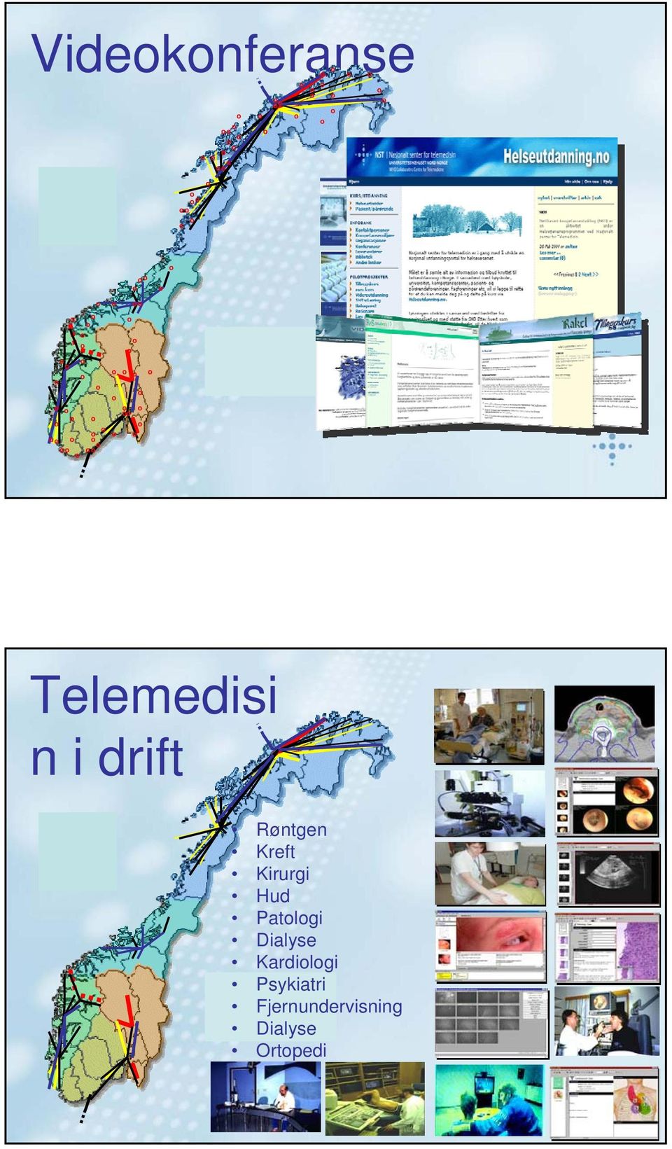 drift Røntgen Kreft Kirurgi Hud Patlgi