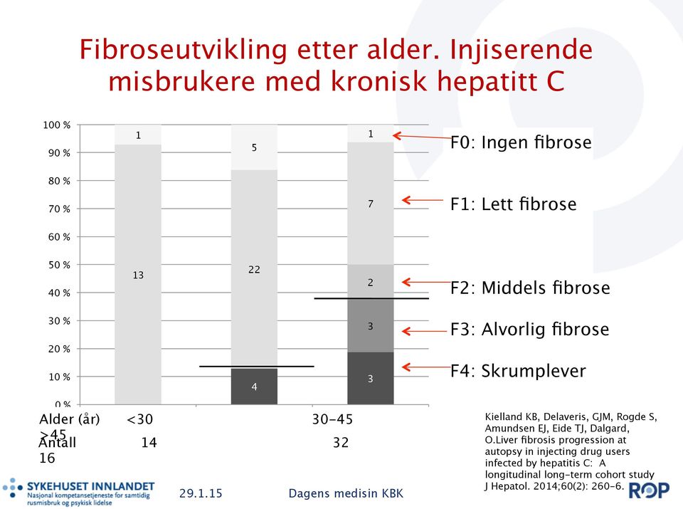 Antall 14 32 16 5 22 4 <30 30-45 >45 1 7 2 3 3 F0: Ingen fibrose F1: Lett fibrose F0 F1 F2 F2: F3 Middels fibrose F4 F3: Alvorlig