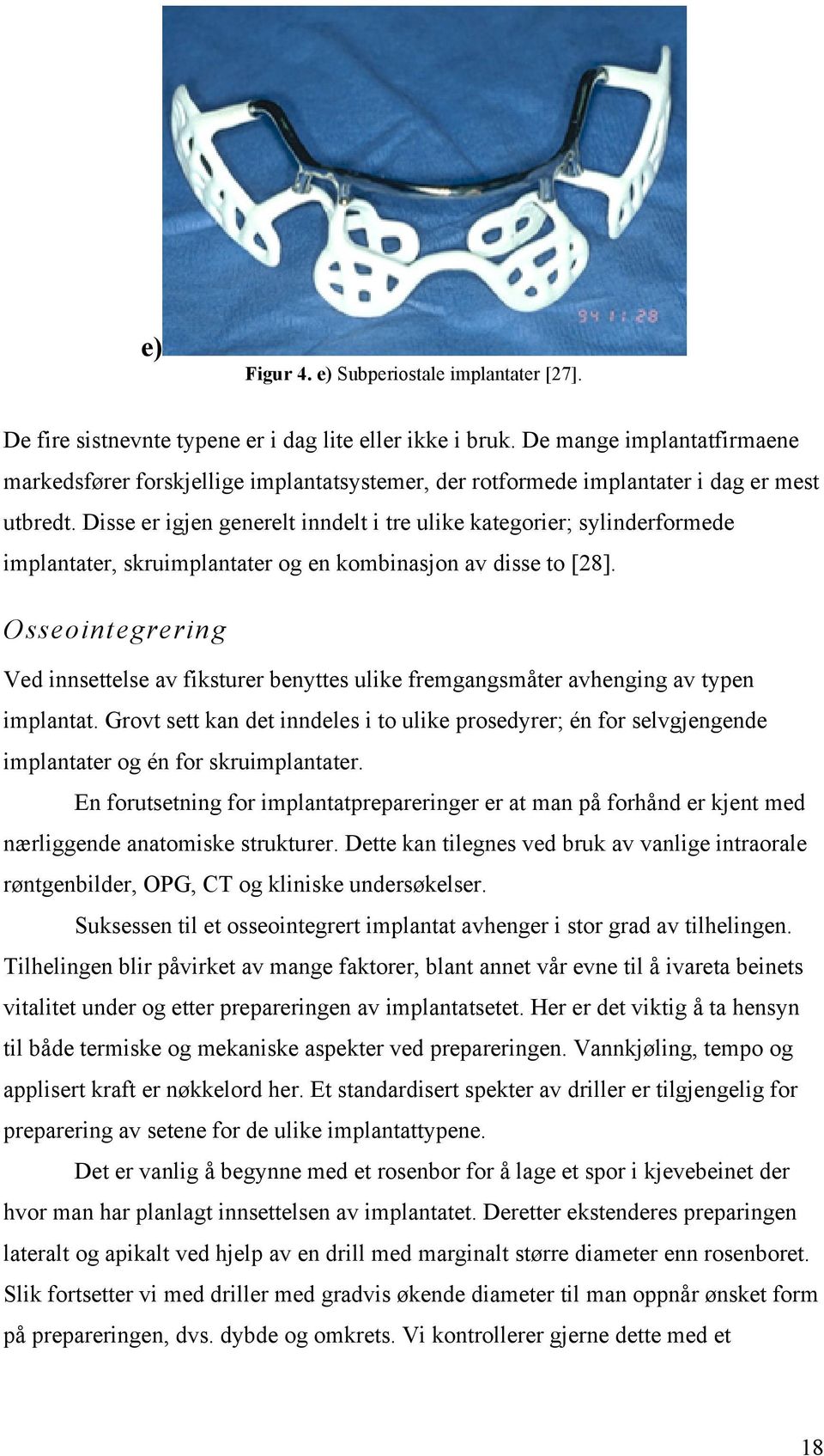 Disse er igjen generelt inndelt i tre ulike kategorier; sylinderformede implantater, skruimplantater og en kombinasjon av disse to [28].