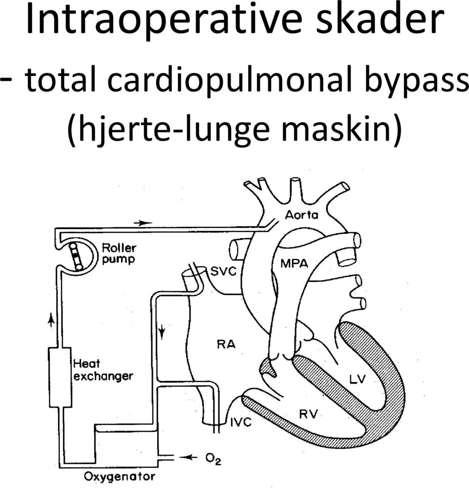 cardiopulmonal