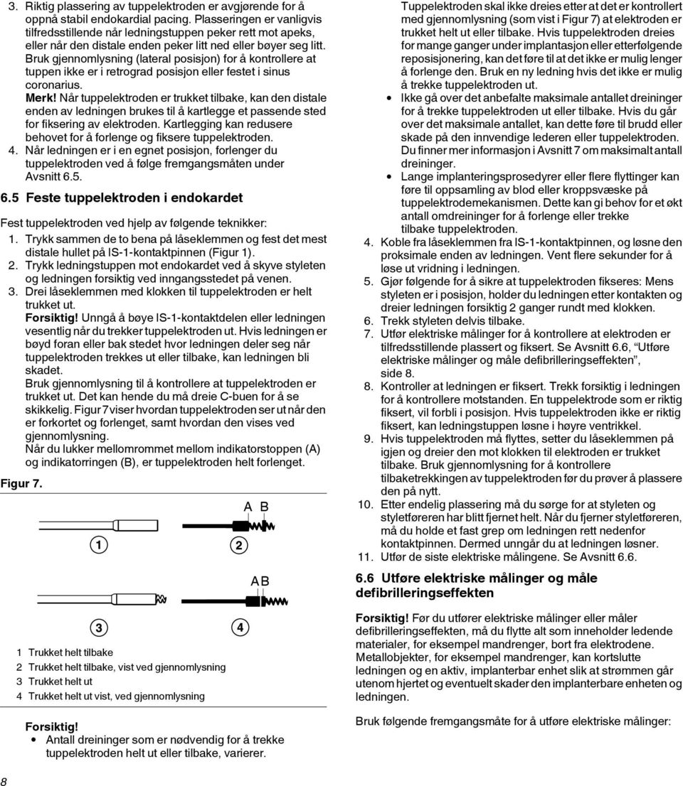 Bruk gjennomlysning (lateral posisjon) for å kontrollere at tuppen ikke er i retrograd posisjon eller festet i sinus coronarius. Merk!