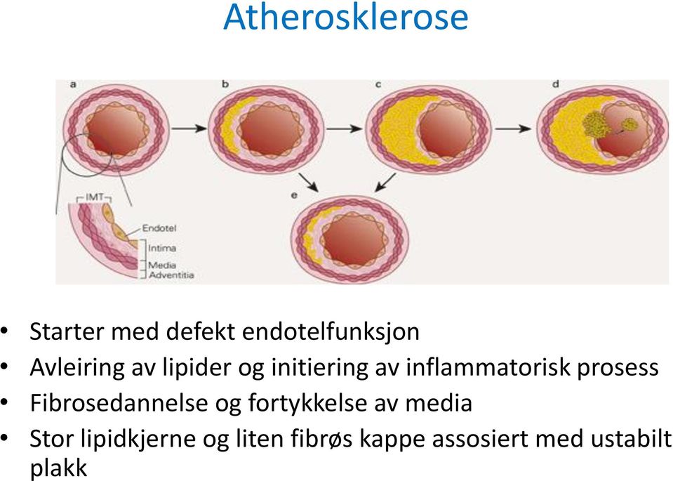 prosess Fibrosedannelse og fortykkelse av media Stor