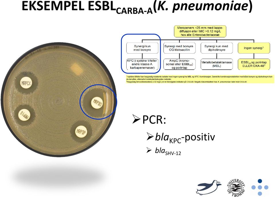 pneumoniae) PCR:
