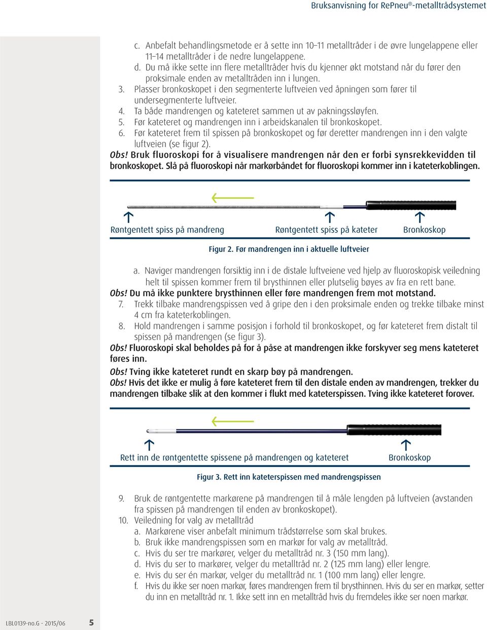 3. Plasser bronkoskopet i den segmenterte luftveien ved åpningen som fører til undersegmenterte luftveier. 4. Ta både mandrengen og kateteret sammen ut av pakningssløyfen. 5.