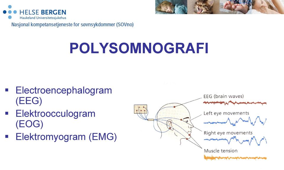 Elektroocculogram