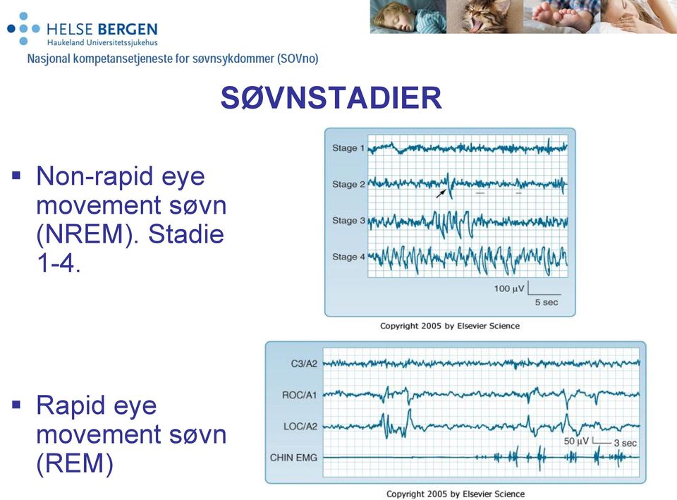 (NREM). Stadie 1-4.