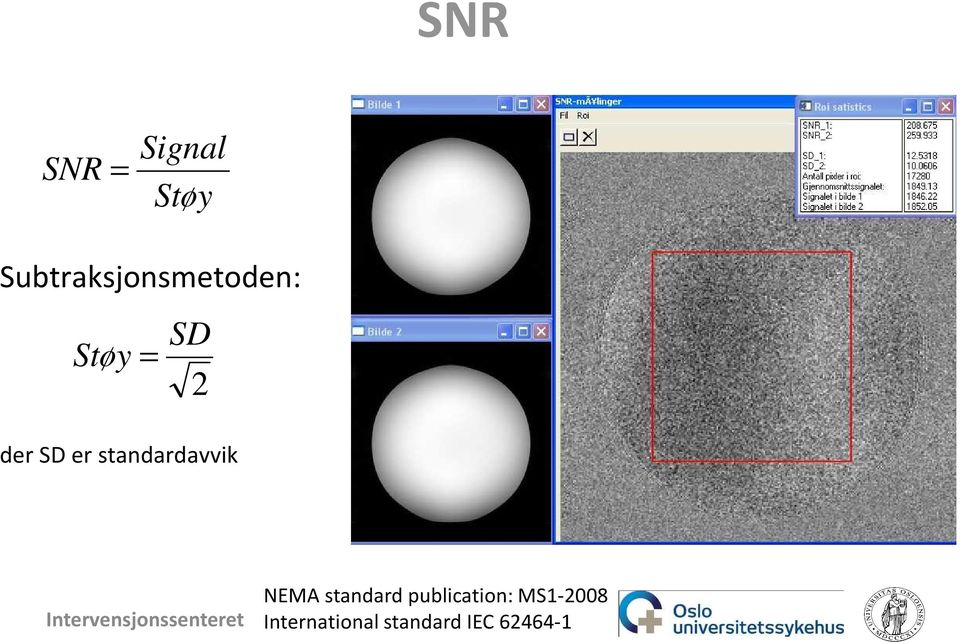 SD er standardavvik NEMA standard