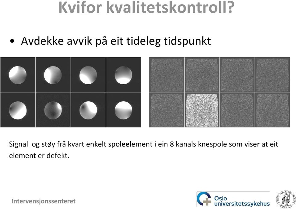 Signal og støy frå kvart enkelt