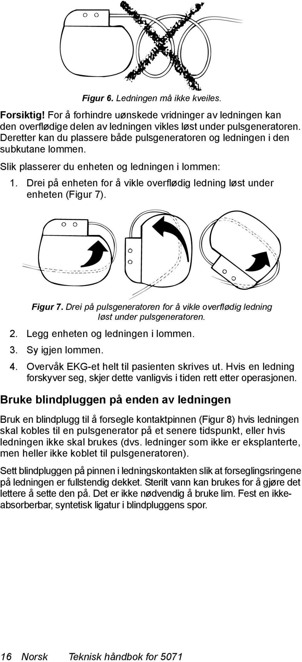 Drei på enheten for å vikle overflødig ledning løst under enheten (Figur 7). Figur 7. Drei på pulsgeneratoren for å vikle overflødig ledning løst under pulsgeneratoren. 2.