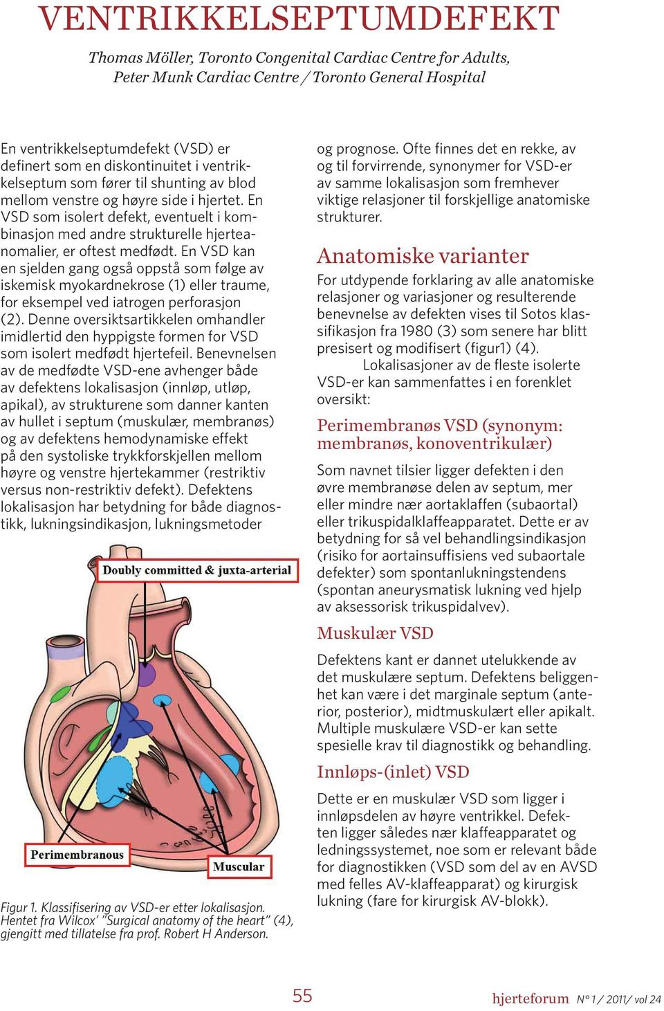 En VSD som isolert defekt, eventuelt i kombinasjon med andre strukturelle hjerteanomalier, er oftest medfødt.