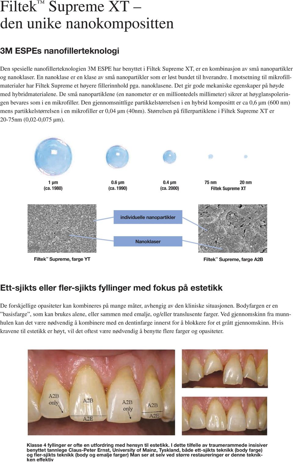 Det gir gode mekaniske egenskaper på høyde med hybridmaterialene. De små nanopartiklene (en nanometer er en milliontedels millimeter) sikrer at høyglanspoleringen bevares som i en mikrofiller.