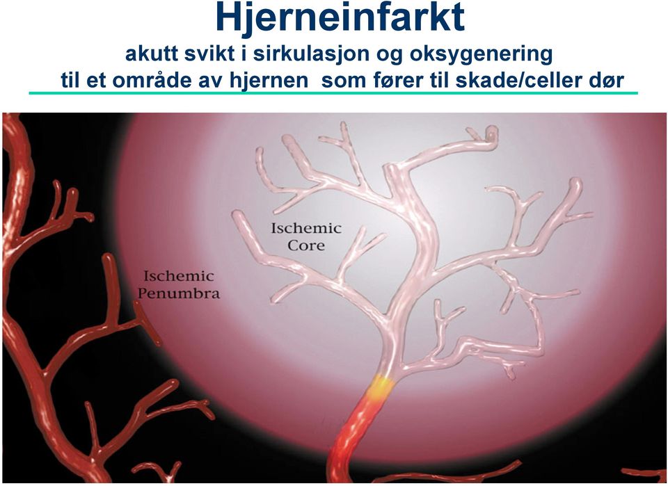 til et område av hjernen som