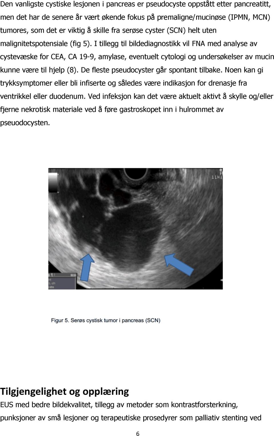 I tillegg til bildediagnostikk vil FNA med analyse av cystevæske for CEA, CA 19-9, amylase, eventuelt cytologi og undersøkelser av mucin kunne være til hjelp (8).