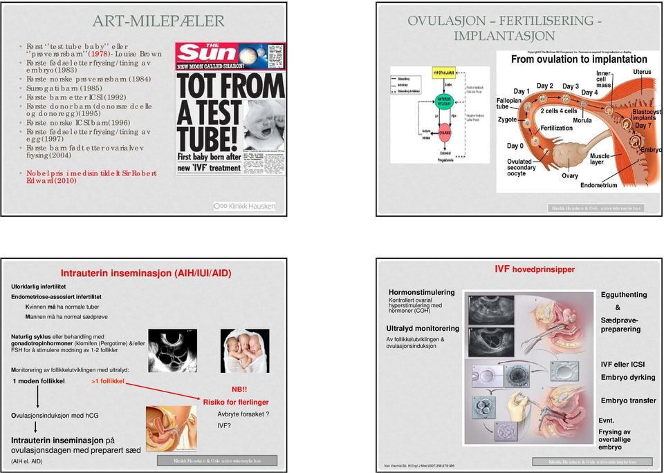 OVULASJON FERTILISERING - IMPLANTASJON Nobel pris i medisin tildelt Sir Robert Edward(2010) 6 Intrauterin inseminasjon (AIH/IUI/AID) IVF hovedprinsipper Uforklarlig infertilitet