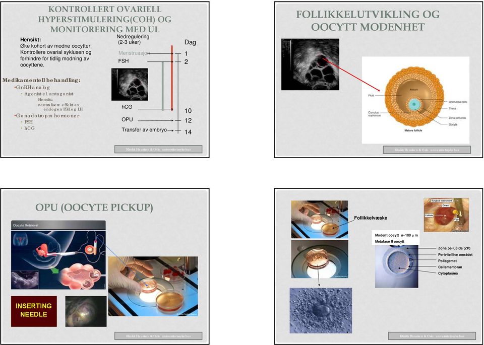 Nedregulering (2-3 uker) Menstruasjon FSH Dag 1 2 FOLLIKKELUTVIKLING OG OOCYTT MODENHET Medikamentell behandling: GnRH analog Agonist el.