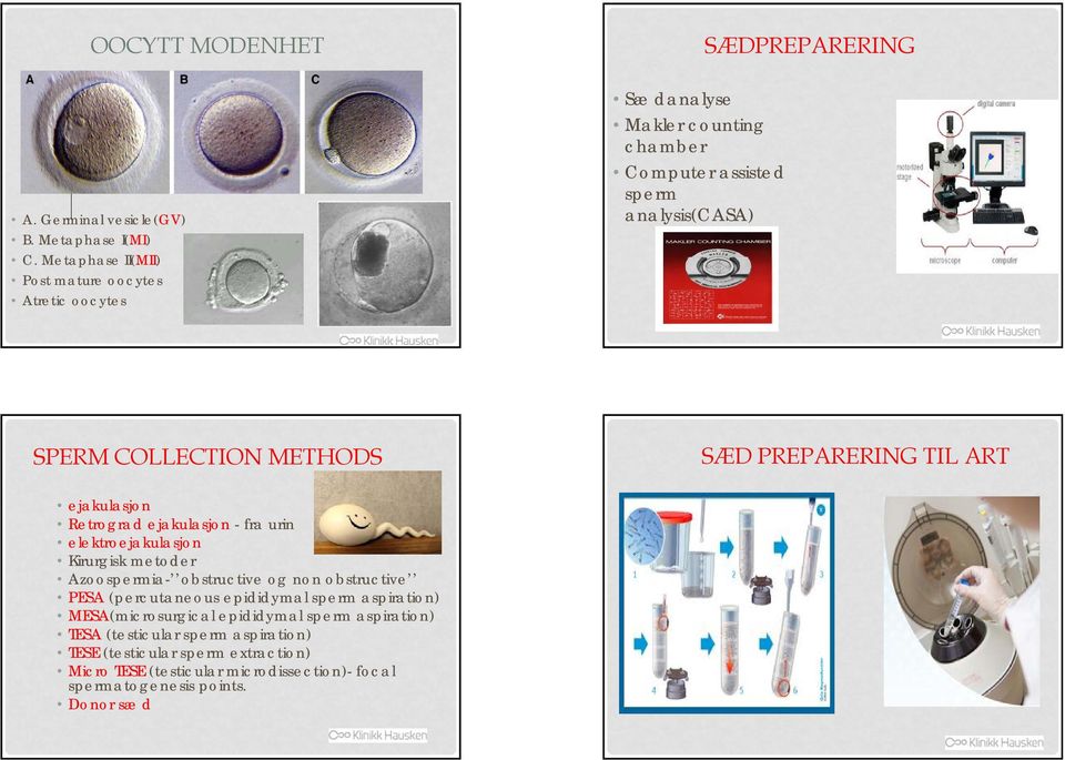 PREPARERING TIL ART ejakulasjon Retrograd ejakulasjon - fra urin elektroejakulasjon Kirurgisk metoder Azoospermia- obstructive og non obstructive PESA