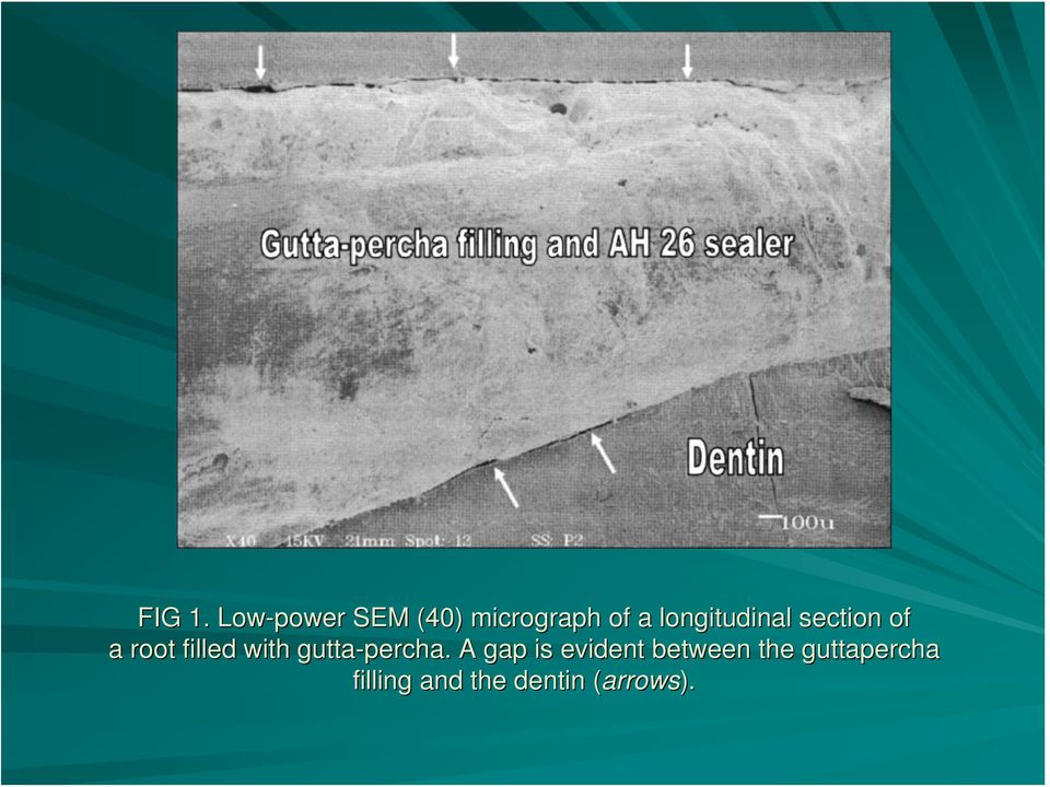 longitudinal section of a root filled with