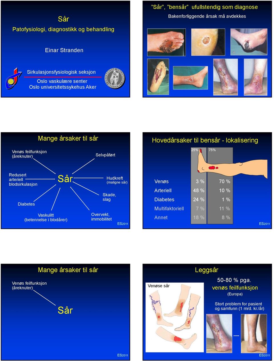 blodsirkulasjon Diabetes Sår Vaskulitt (betennelse i blodårer) Skade, slag Overvekt, immobilitet Hudkreft (maligne sår) 3 % 7 % Arteriell 48 % 1 % Diabetes 24 % 1 %