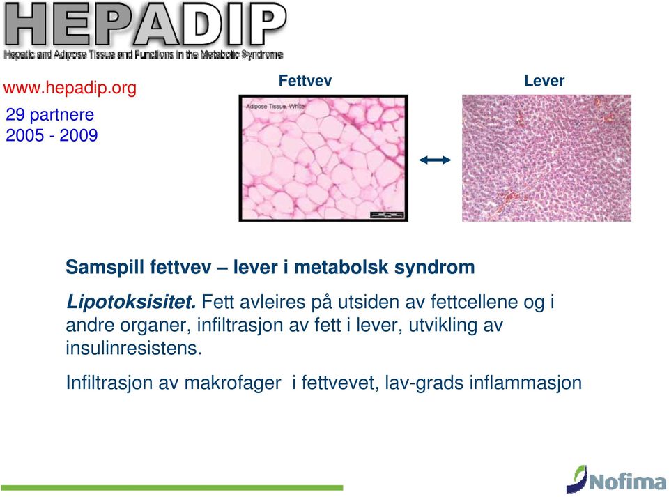 metabolsk syndrom Lipotoksisitet.