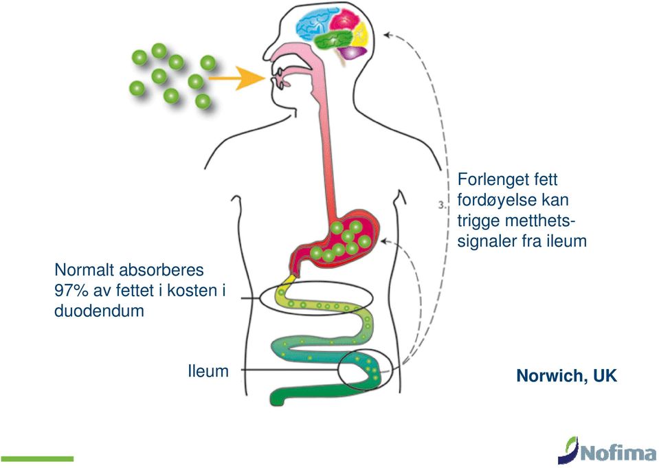 fett fordøyelse kan trigge