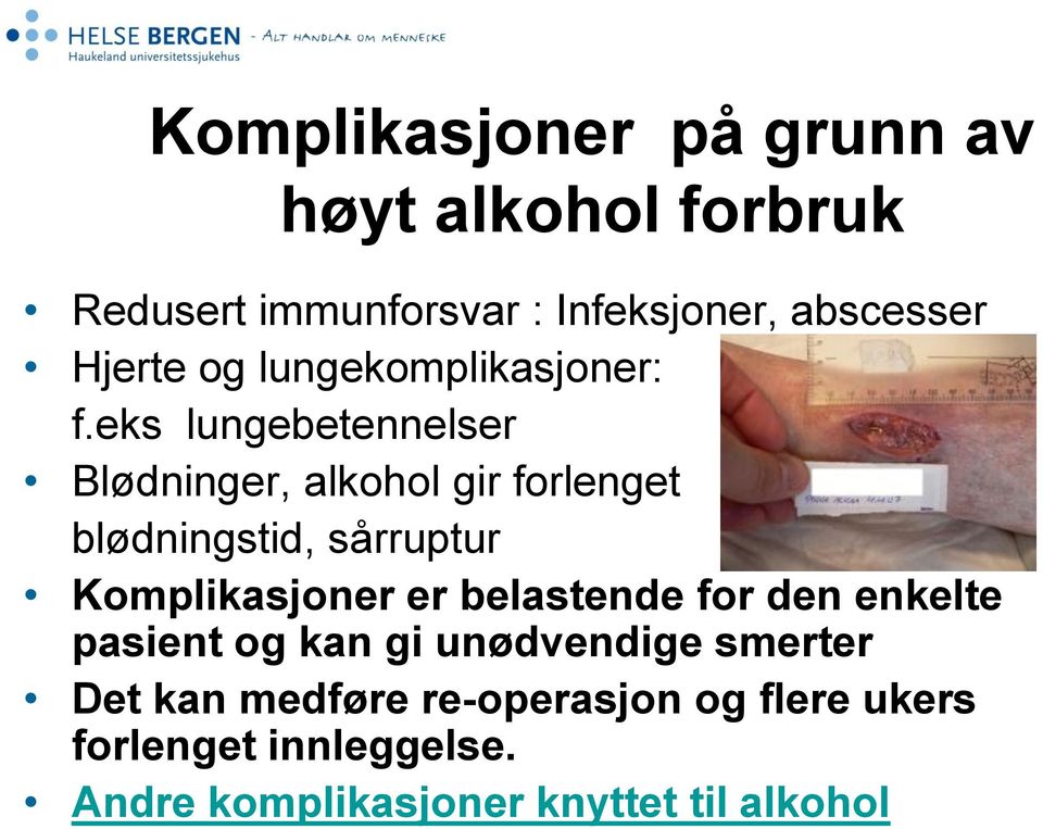 eks lungebetennelser Blødninger, alkohol gir forlenget blødningstid, sårruptur Komplikasjoner er