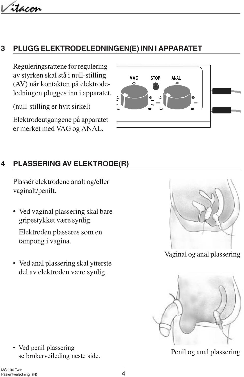 4 PLASSERING AV ELEKTRODE(R) Plassér elektrodene analt og/eller vaginalt/penilt. Ved vaginal plassering skal bare gripestykket være synlig.