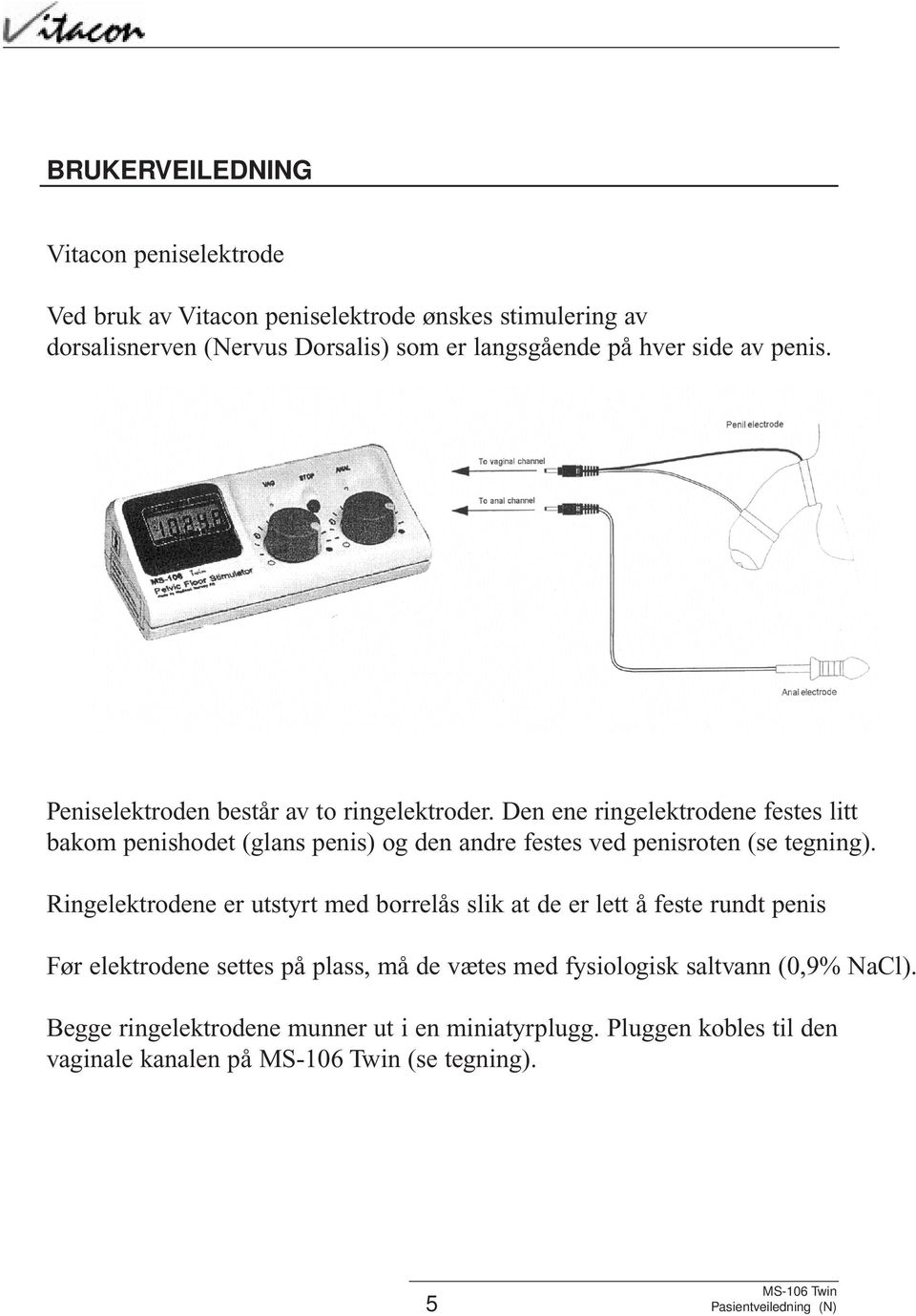 Den ene ringelektrodene festes litt bakom penishodet (glans penis) og den andre festes ved penisroten (se tegning).