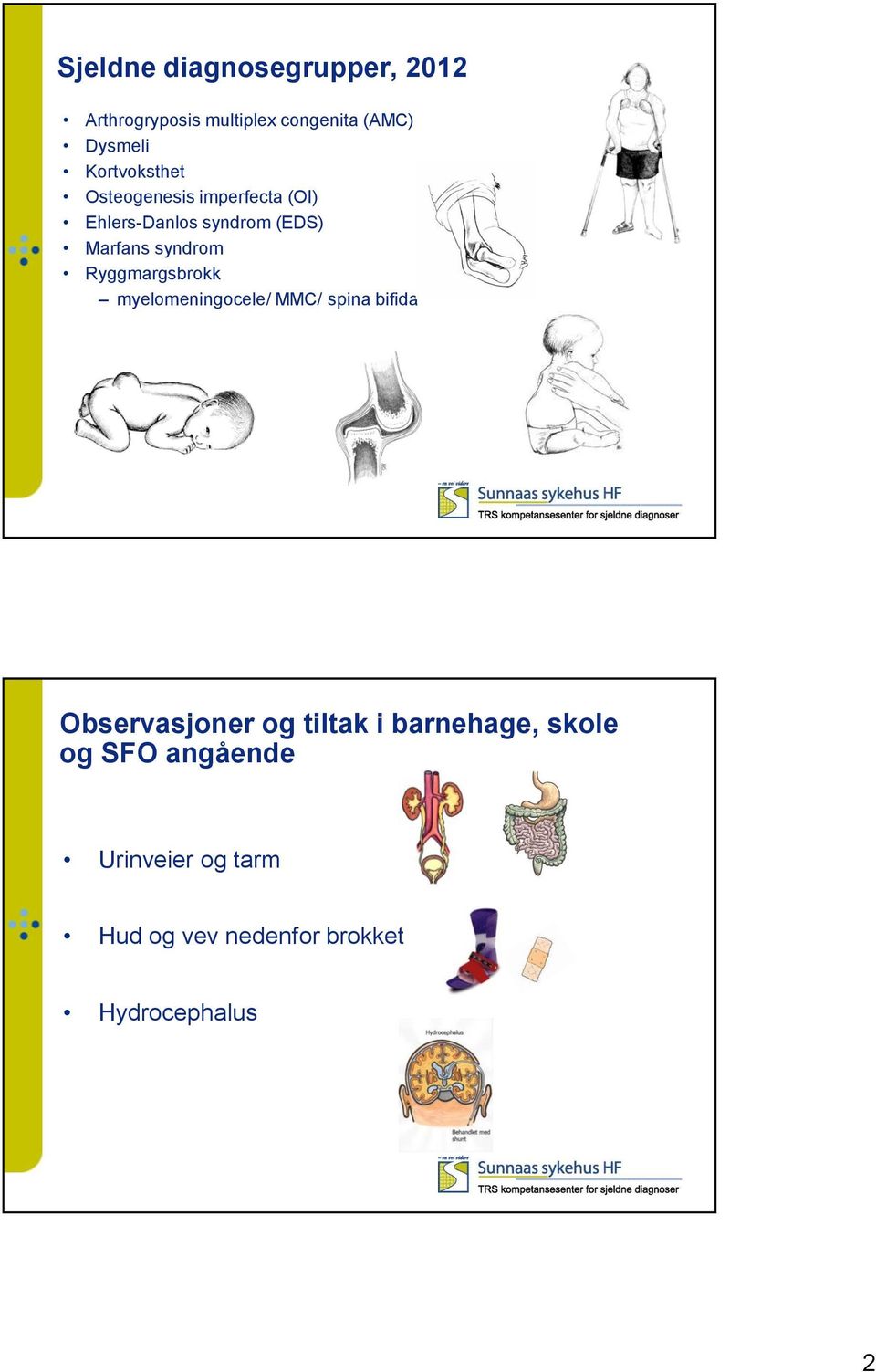 syndrom Ryggmargsbrokk myelomeningocele/ MMC/ spina bifida Observasjoner og tiltak