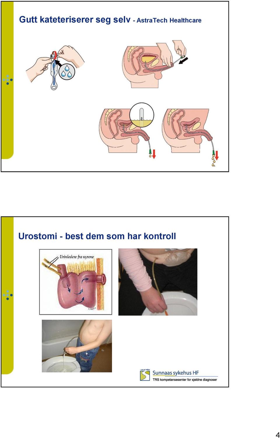 Healthcare Urostomi -