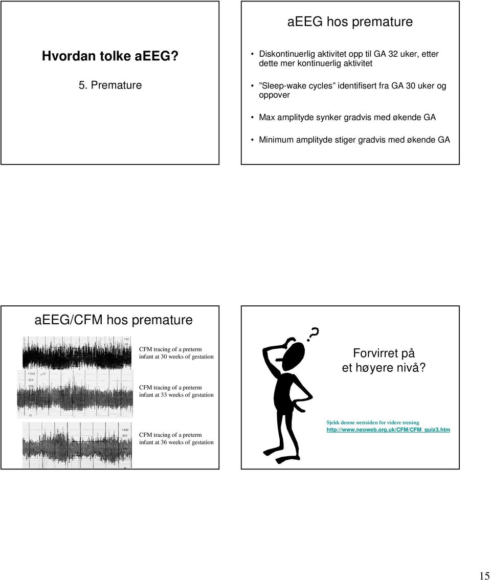 oppover Max amplityde synker gradvis med økende GA Minimum amplityde stiger gradvis med økende GA aeeg/cfm hos premature CFM tracing of a