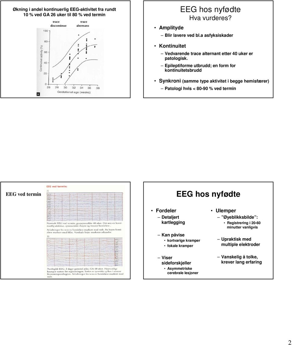 Epileptiforme utbrudd; en form for kontinuitetsbrudd Synkroni (samme type aktivitet i begge hemisfærer) Patologi hvis < 80-90 % ved termin EEG ved termin EEG hos