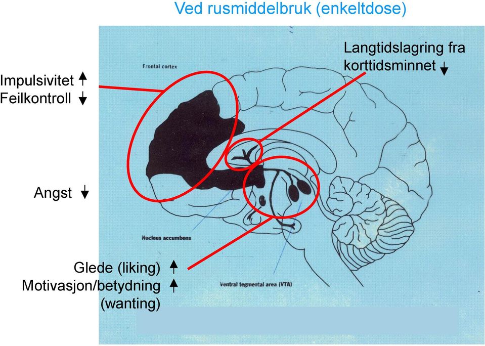 Langtidslagring fra korttidsminnet