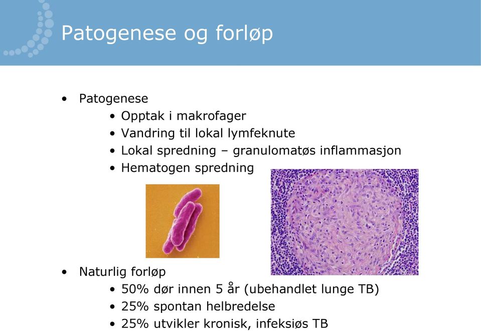 Hematogen spredning Naturlig forløp 50% dør innen 5 år