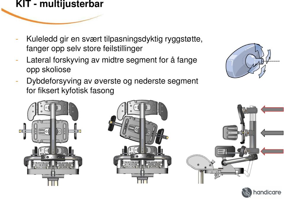 forskyving av midtre segment for å fange opp skoliose -