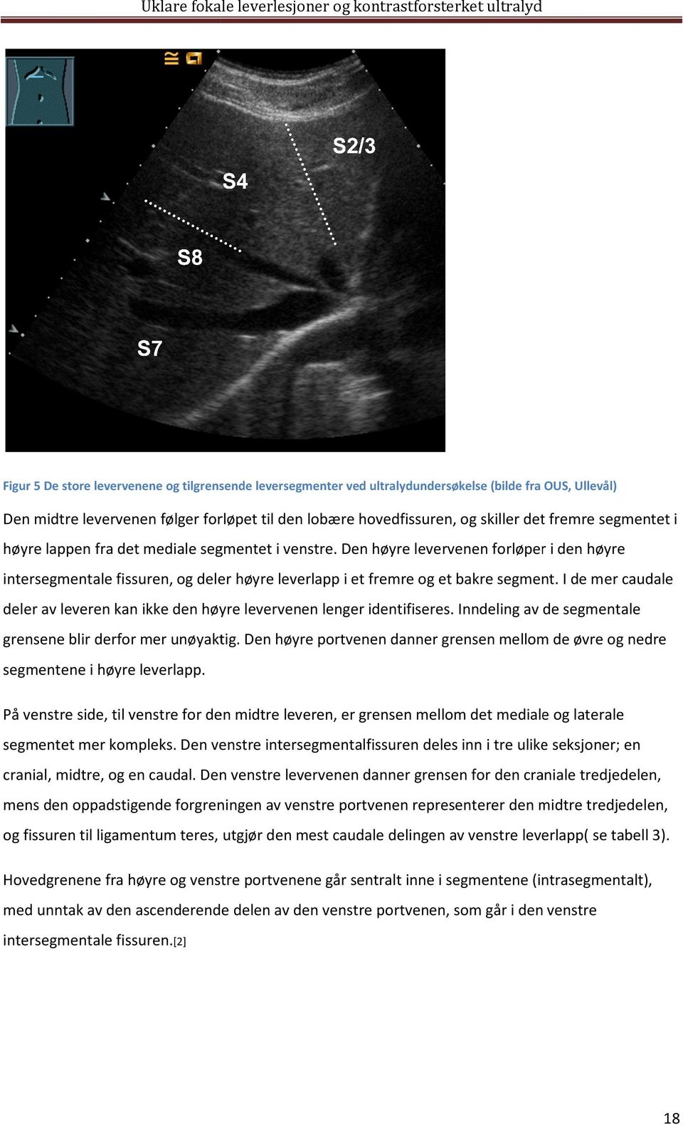 Den høyre levervenen forløper orløper i den høyre intersegmentale fissuren, og deler høyre lever leverlapp i et fremre og et bakre segment.