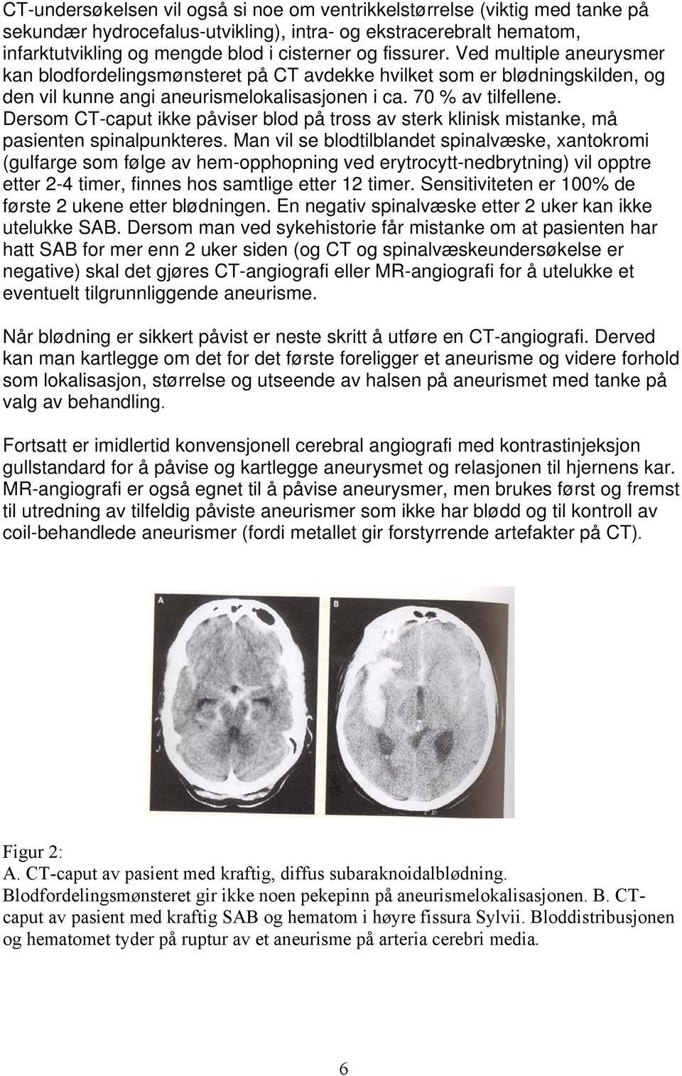 Dersom CT-caput ikke påviser blod på tross av sterk klinisk mistanke, må pasienten spinalpunkteres.