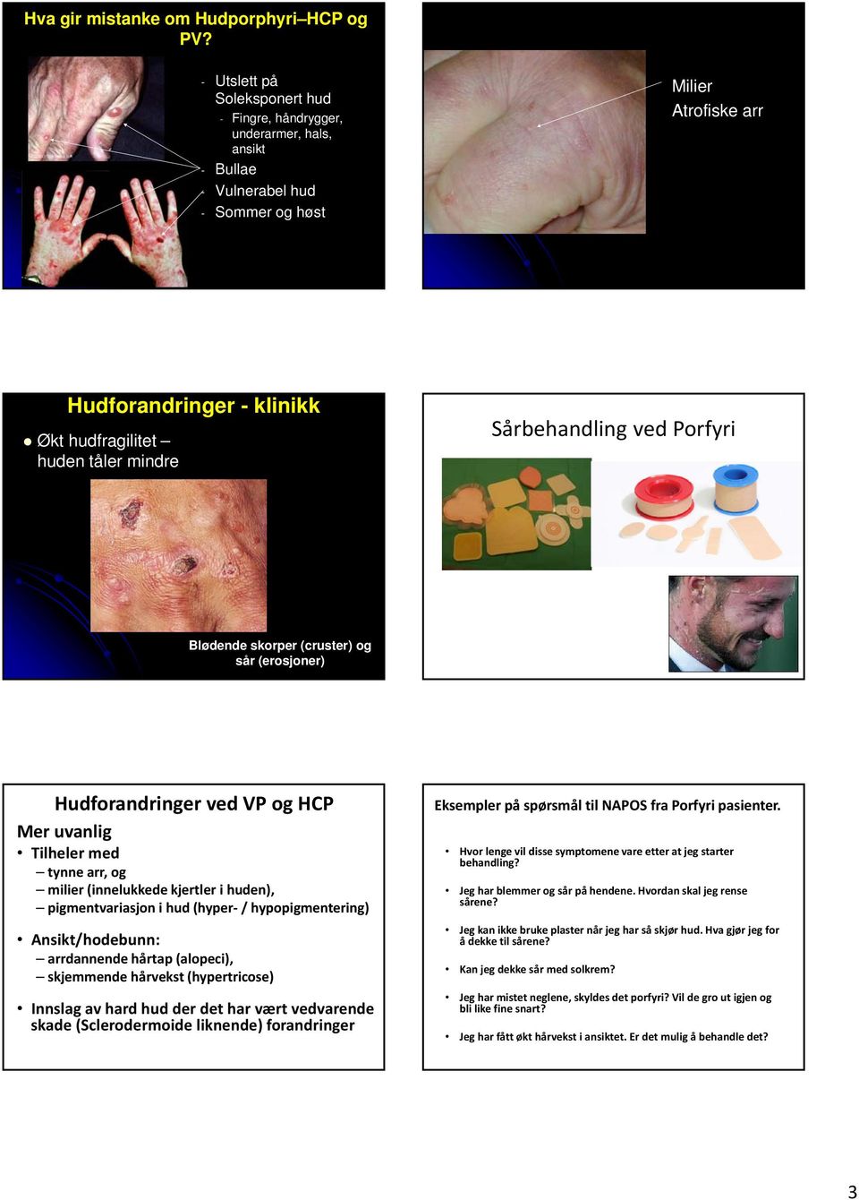 mindre Sårbehandling ved Porfyri Blødende skorper (cruster) og sår (erosjoner) Hudforandringer ved VP og HCP Mer uvanlig Tilheler med tynne arr, og milier (innelukkede kjertler i huden),