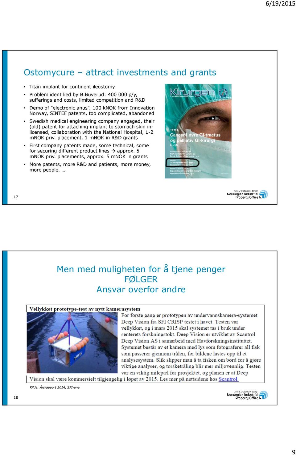 engineering company engaged, their (old) patent for attaching implant to stomach skin inlicensed, collaboration with the National Hospital, 1-2 mnokpriv.