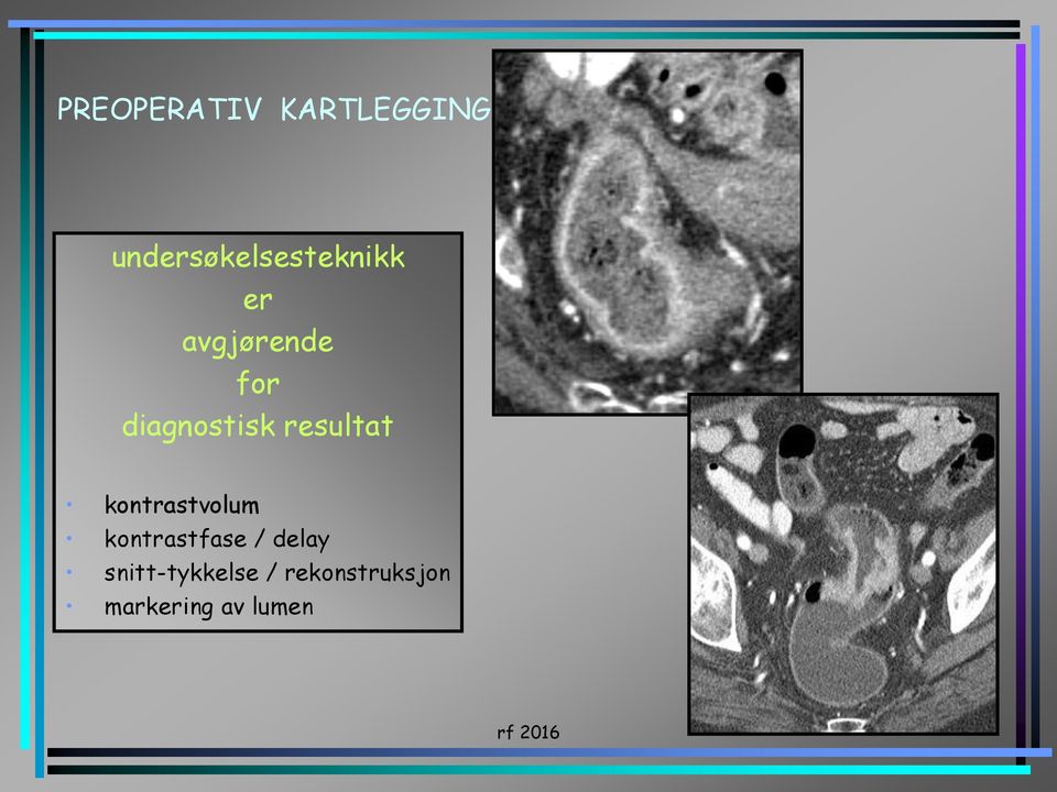 diagnostisk resultat kontrastvolum