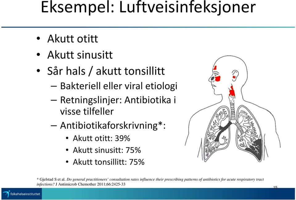 sinusitt: 75% Akutt tonsillitt: 75% * Gjelstad S et al.