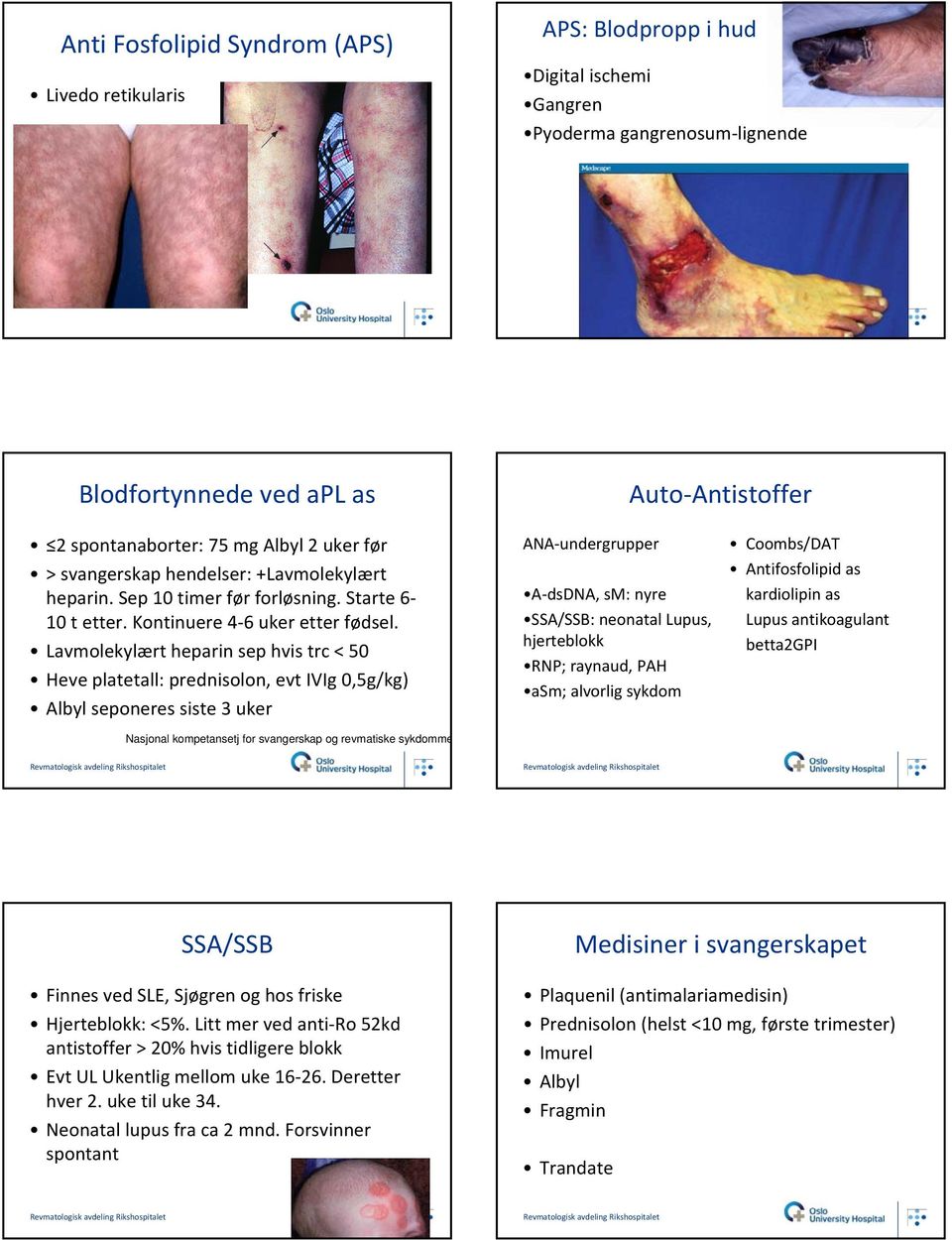 Lavmolekylært heparin sep hvis trc < 50 Heve platetall: prednisolon, evt IVIg 0,5g/kg) Albyl seponeres siste 3 uker Nasjonal kompetansetj for svangerskap og revmatiske sykdomme ANA undergrupper A