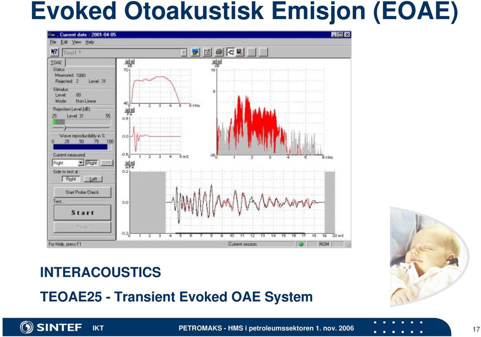 INTERACOUSTICS TEOAE25