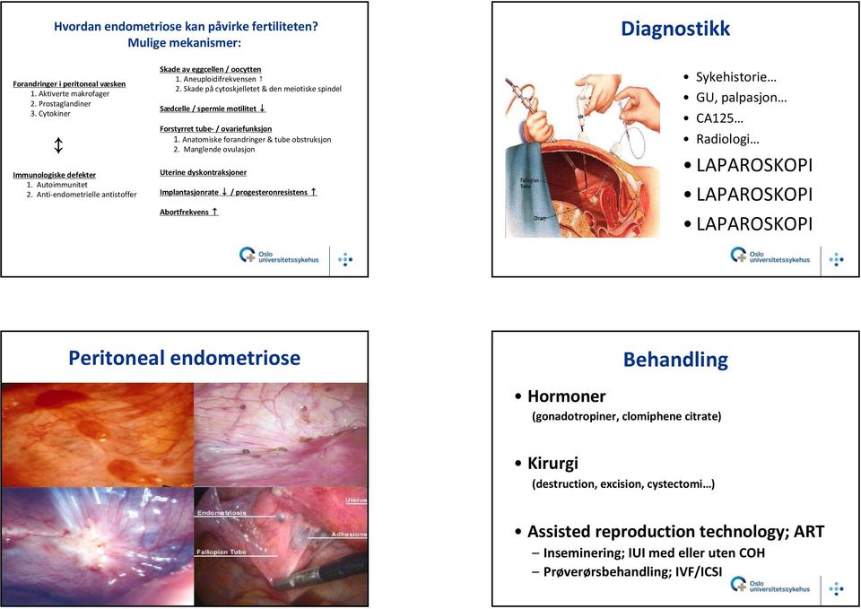 Skade på cytoskjelletet & den meiotiske spindel Sædcelle / spermie motilitet Forstyrret tube / ovariefunksjon 1. Anatomiske forandringer & tube obstruksjon 2.