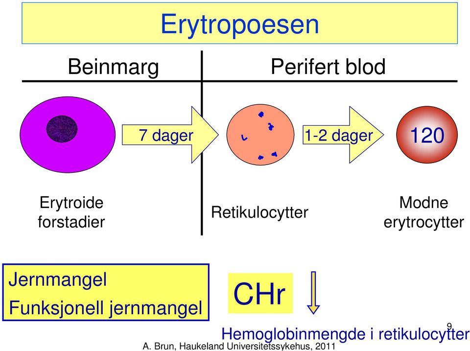 Retikulocytter Modne erytrocytter Jernmangel