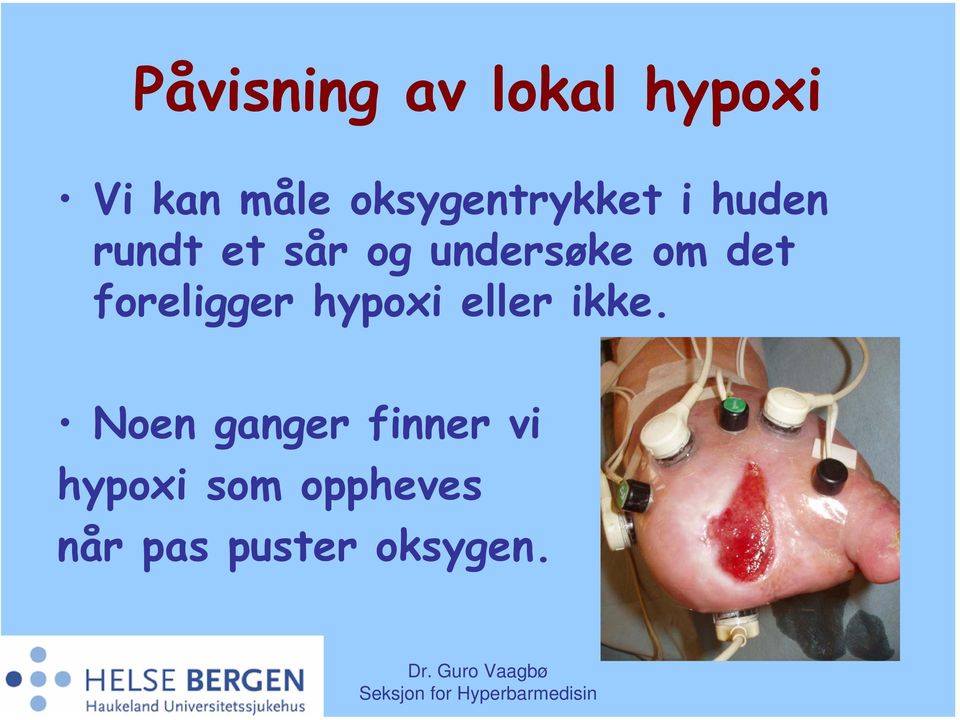 undersøke om det foreligger hypoxi eller ikke.